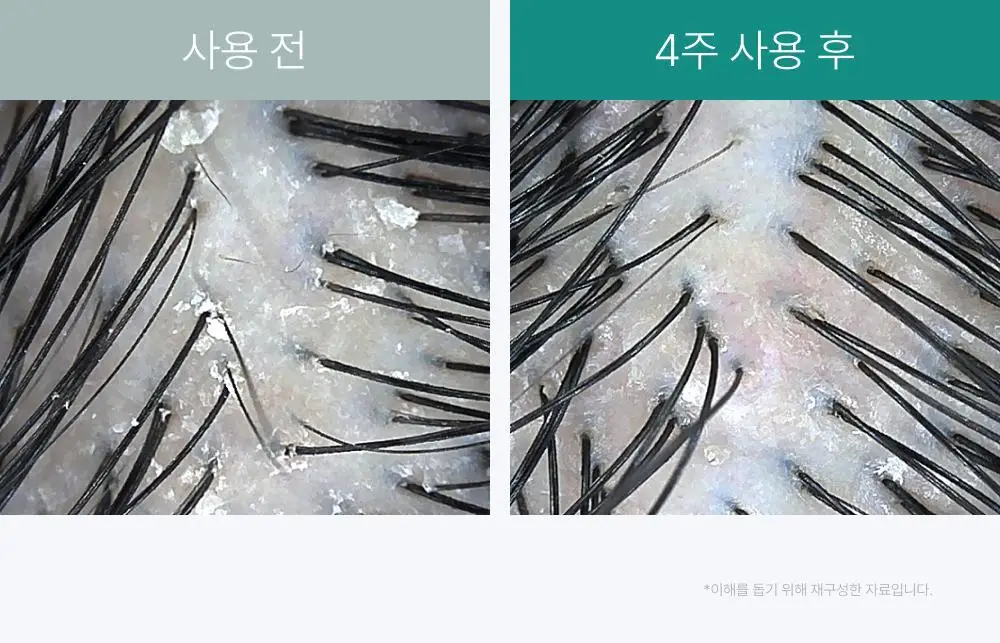 [포켓몬 에디션][비듬/각질케어]릴리이브 스칼프턴 시카 PDRN 브러쉬 앰플 100ml 2종 택1 상세페이지 30